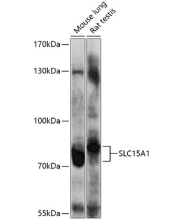 SLC15A1 Rabbit Polyclonal Antibody