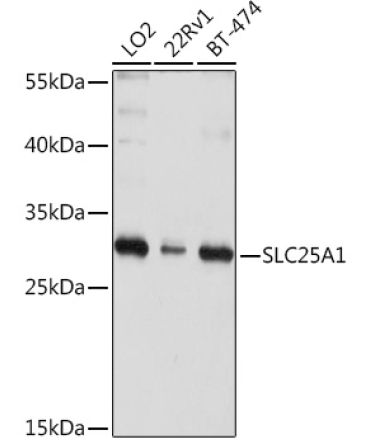 SLC25A1 Rabbit Polyclonal Antibody