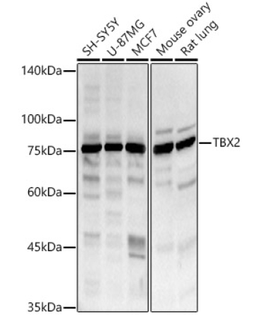 TBX2 Rabbit Polyclonal Antibody
