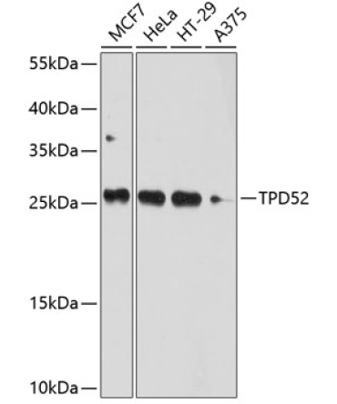 TPD52 Rabbit Polyclonal Antibody