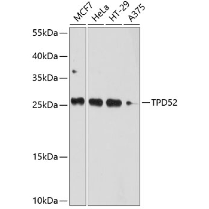 TPD52 Rabbit Polyclonal Antibody