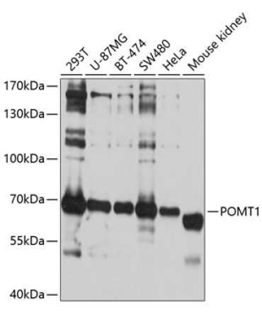 POMT1 Rabbit Polyclonal Antibody