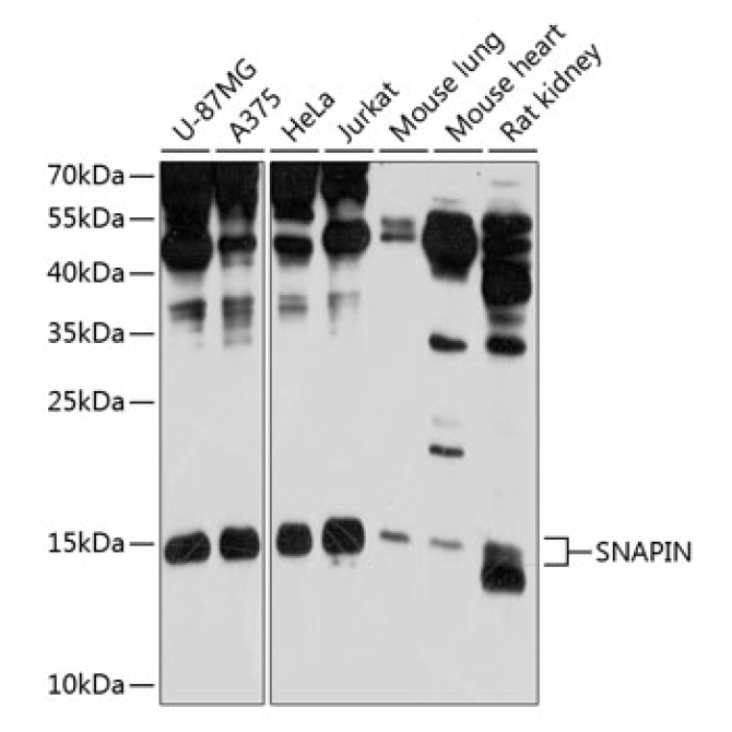 SNAPIN Rabbit Polyclonal Antibody