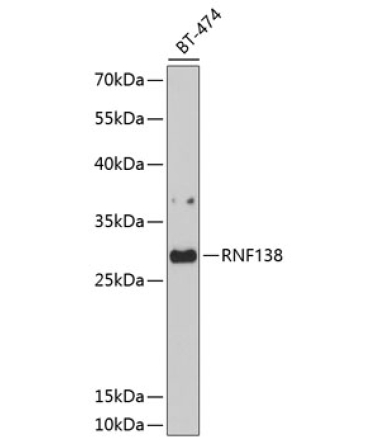 RNF138 Rabbit Polyclonal Antibody
