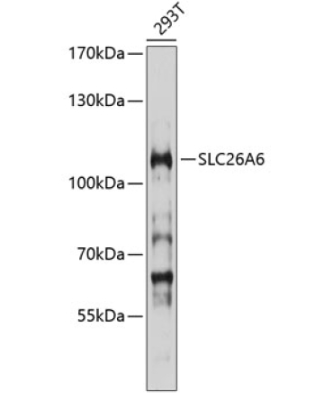 SLC26A6 Rabbit Polyclonal Antibody