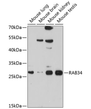 RAB34 Rabbit Polyclonal Antibody