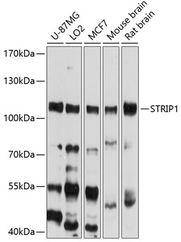 STRIP1 Rabbit Polyclonal Antibody