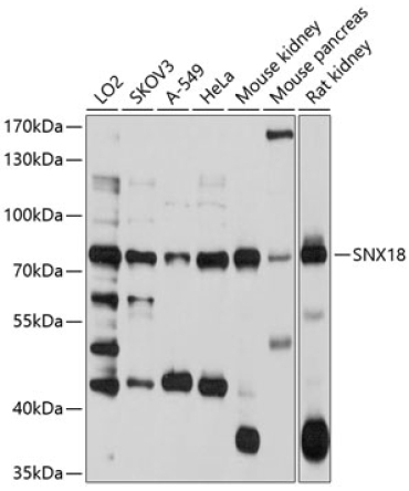 SNX18 Rabbit Polyclonal Antibody