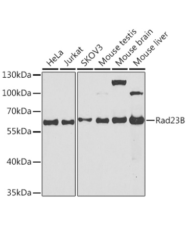 Rad23B Rabbit Polyclonal Antibody
