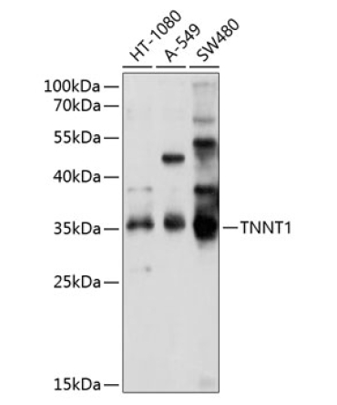 TNNT1 Rabbit Polyclonal Antibody