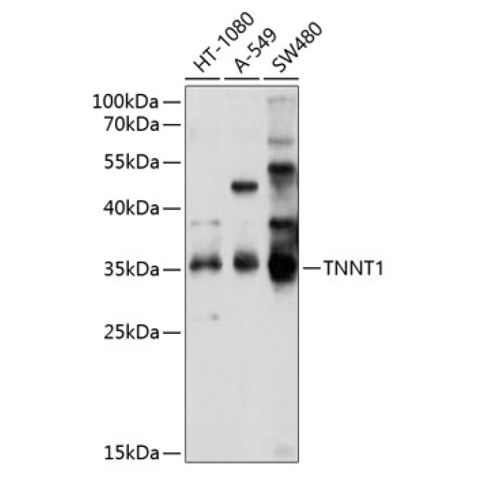 TNNT1 Rabbit Polyclonal Antibody