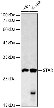 StAR Rabbit Polyclonal Antibody