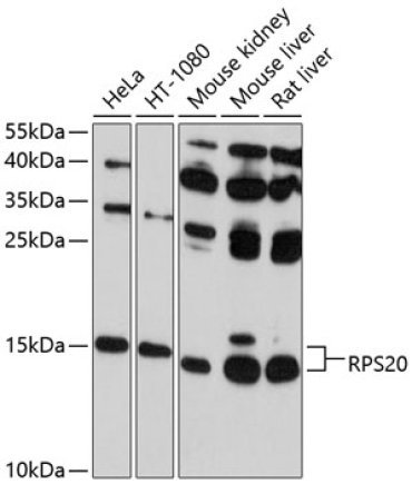 RPS20 Rabbit Polyclonal Antibody