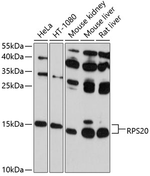 RPS20 Rabbit Polyclonal Antibody