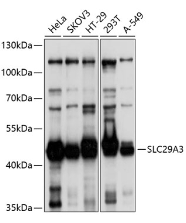 SLC29A3 Rabbit Polyclonal Antibody