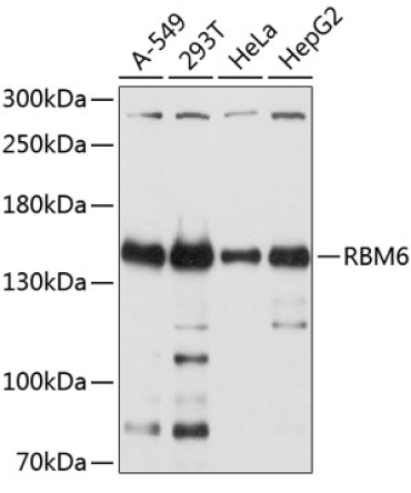 RBM6 Rabbit Polyclonal Antibody