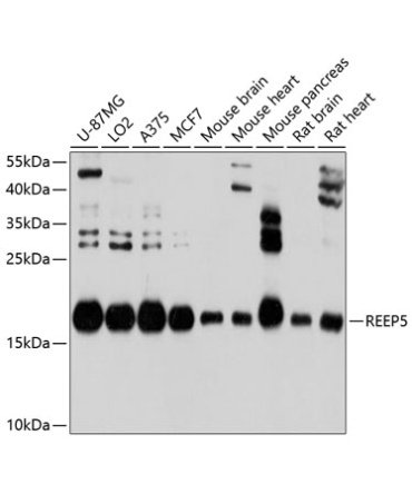 REEP5 Rabbit Polyclonal Antibody