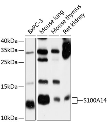 S100A14 Rabbit Polyclonal Antibody