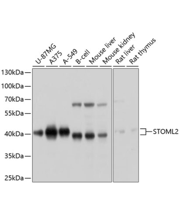 STOML2 Rabbit Polyclonal Antibody