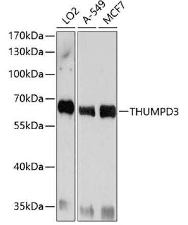 THUMPD3 Rabbit Polyclonal Antibody