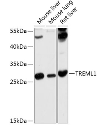TREML1 Rabbit Polyclonal Antibody