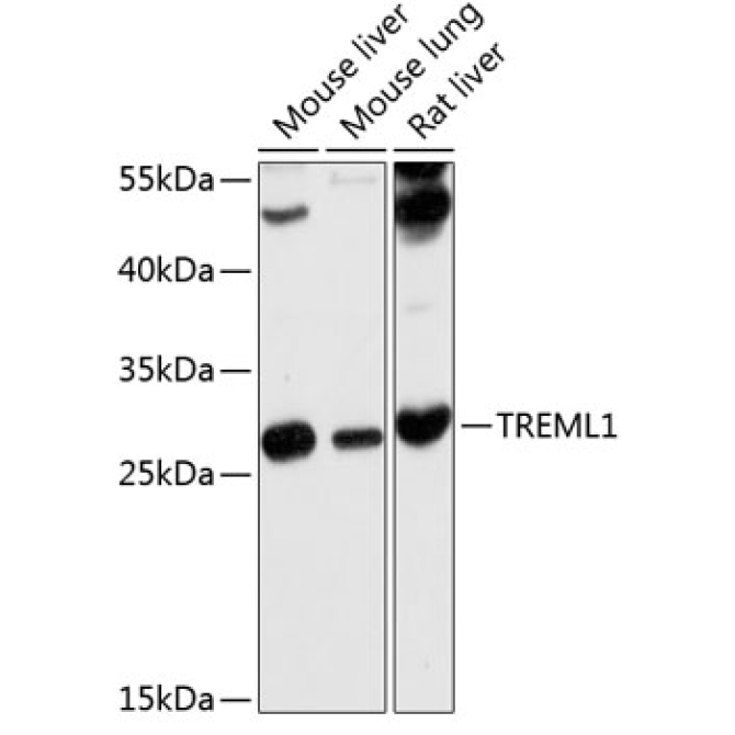 TREML1 Rabbit Polyclonal Antibody