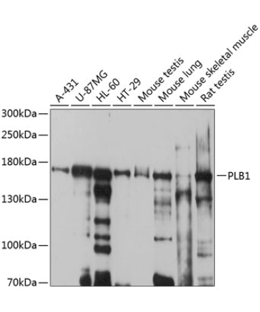 PLB1 Rabbit Polyclonal Antibody