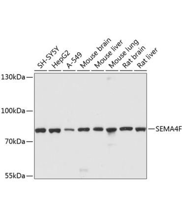 SEMA4F Rabbit Polyclonal Antibody