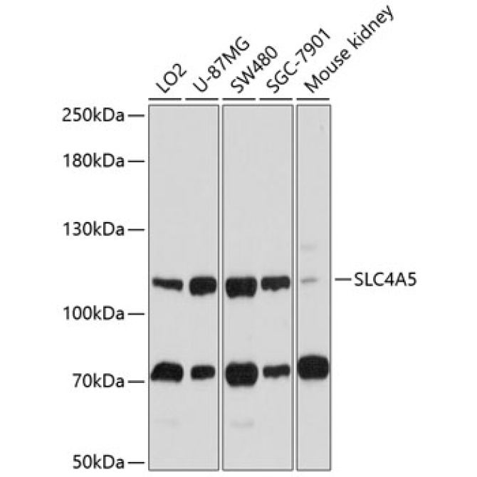 SLC4A5 Rabbit Polyclonal Antibody