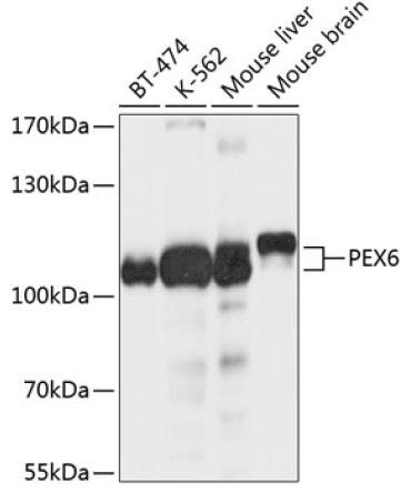 PEX6 Rabbit Polyclonal Antibody