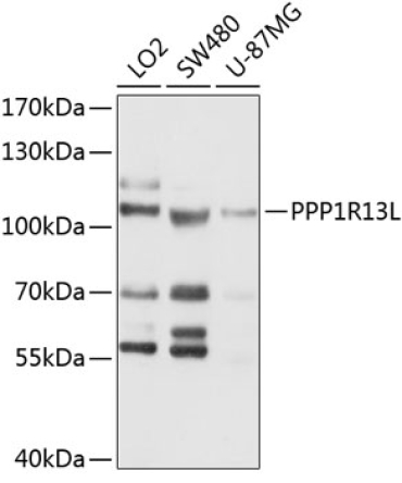 PPP1R13L Rabbit Polyclonal Antibody