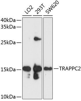 TRAPPC2 Rabbit Polyclonal Antibody