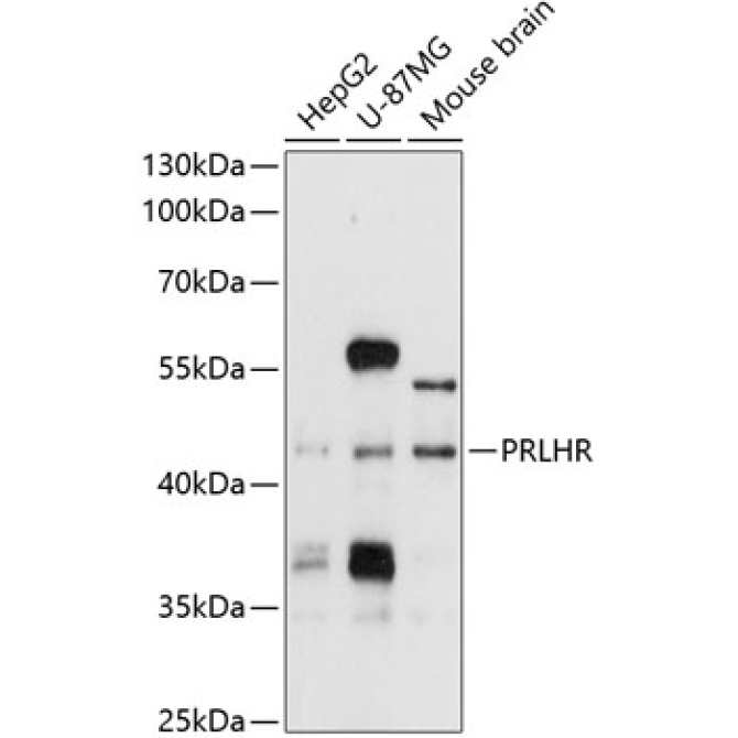 PRLHR Rabbit Polyclonal Antibody