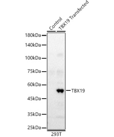 TBX19 Rabbit Polyclonal Antibody