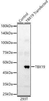 TBX19 Rabbit Polyclonal Antibody