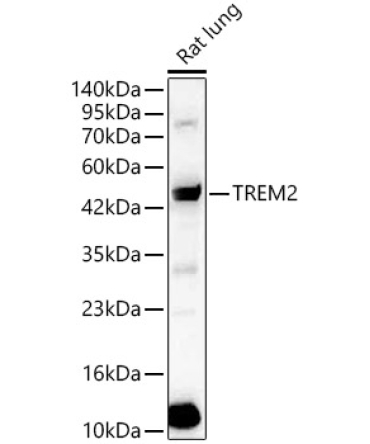 TREM2 Rabbit Polyclonal Antibody