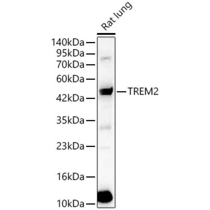 TREM2 Rabbit Polyclonal Antibody