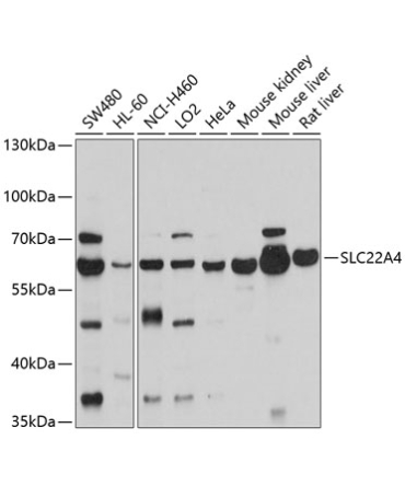 SLC22A4 Rabbit Polyclonal Antibody