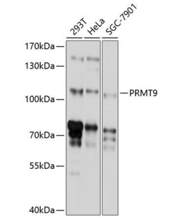 PRMT9 Rabbit Polyclonal Antibody