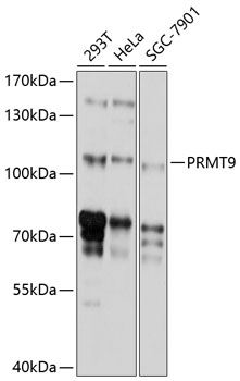 PRMT9 Rabbit Polyclonal Antibody