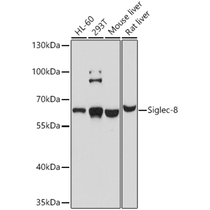 Siglec-8 Rabbit Polyclonal Antibody
