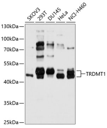 TRDMT1 Rabbit Polyclonal Antibody