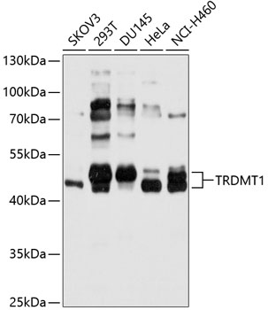 TRDMT1 Rabbit Polyclonal Antibody