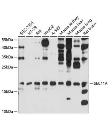 SEC11A Rabbit Polyclonal Antibody