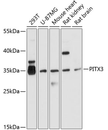 PITX3 Rabbit Polyclonal Antibody