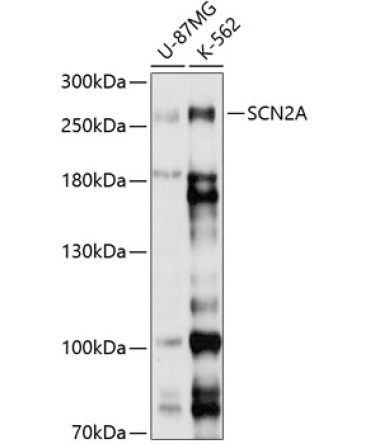 SCN2A Rabbit Polyclonal Antibody