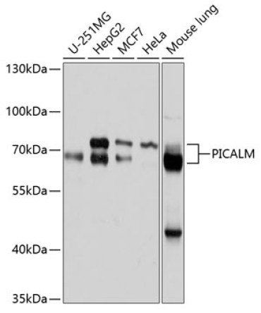 PICALM Rabbit Polyclonal Antibody