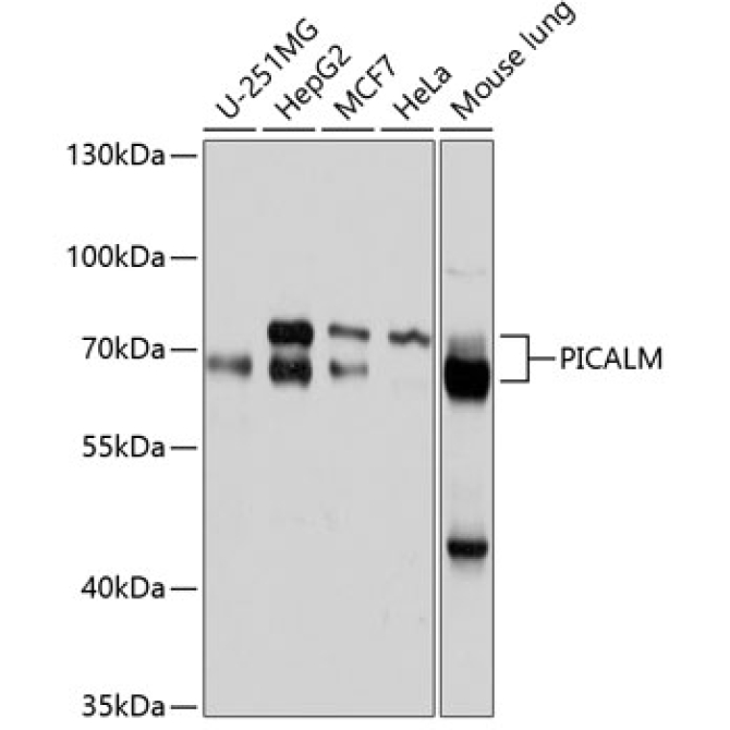 PICALM Rabbit Polyclonal Antibody