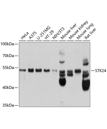 STK24 Rabbit Polyclonal Antibody