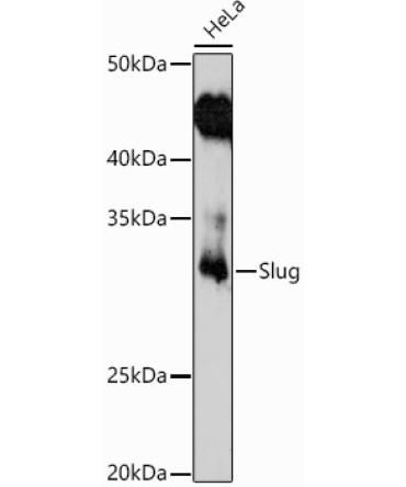 Slug Rabbit Polyclonal Antibody